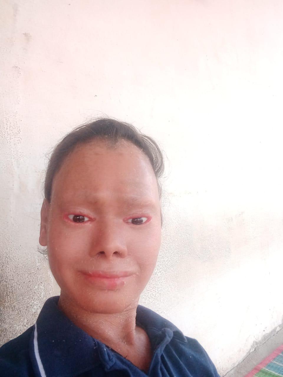 Portrait of Shalini Yadav smiling during her 2017 treatment
